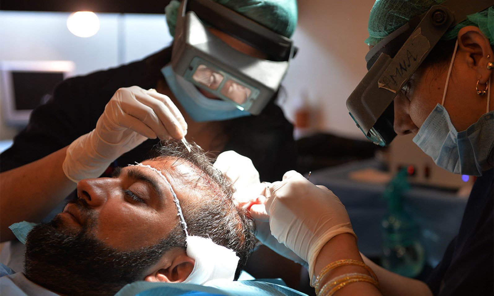 Hair Transplant